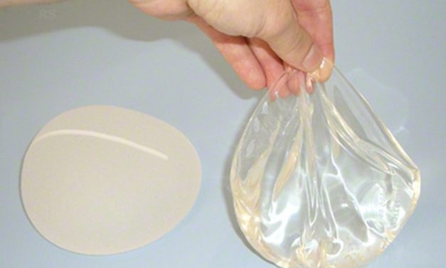 Unsur Kimia Silikon Peran Penting Bagi Manusia