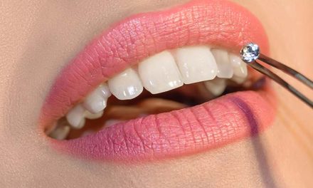Aksesoris Gigi Yang Berbentuk Seperti Berlian