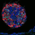 Sel Beta Yang Memproduksi Insulin Bagi Tubuh Manusia