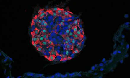 Sel Beta Yang Memproduksi Insulin Bagi Tubuh Manusia